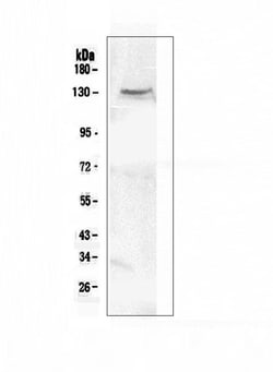Invitrogen CACNA2D2 Polyclonal Antibody 100 &mu;g | Buy Online | Invitrogen&trade; | Fisher Scientific