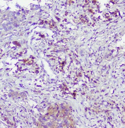 Invitrogen Caspase 2 Polyclonal Antibody 100 &mu;g; Unconjugated:Antibodies,