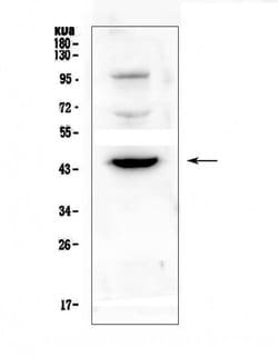 Invitrogen CD72 Polyclonal Antibody 100 &mu;g; Unconjugated:Antibodies,
