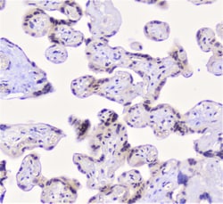 Invitrogen Properdin Polyclonal Antibody 100 &mu;g; Unconjugated:Antibodies,