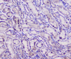 Invitrogen Properdin Polyclonal Antibody 100 &mu;g; Unconjugated:Antibodies,