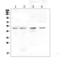 Invitrogen Properdin Polyclonal Antibody 100 &mu;g; Unconjugated:Antibodies,