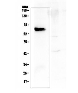 Invitrogen COMP Polyclonal Antibody 100 &mu;g; Unconjugated:Antikroppar