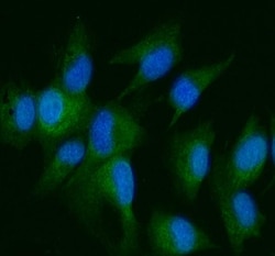 Invitrogen DDR2 Polyclonal Antibody 100 &mu;g; Unconjugated:Antibodies,
