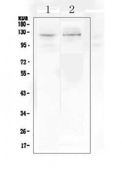 Invitrogen DDR2 Polyclonal Antibody 100 &mu;g; Unconjugated:Antibodies,