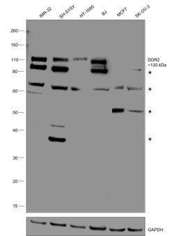 Invitrogen DDR2 Polyclonal Antibody 100 &mu;g; Unconjugated:Antibodies,