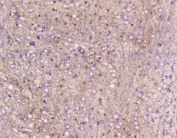 Invitrogen ELAVL2 Polyclonal Antibody 100 &mu;g | Buy Online | Invitrogen&trade; | Fisher Scientific