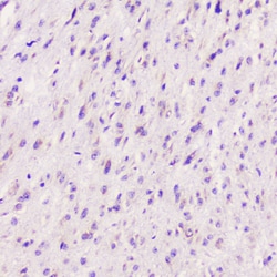 Invitrogen ELAVL2 Polyclonal Antibody 100 &mu;g | Buy Online | Invitrogen&trade; | Fisher Scientific