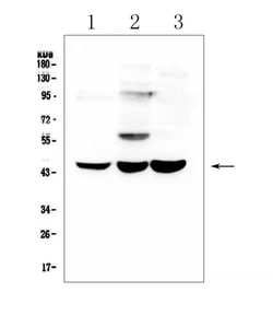 Invitrogen ELAVL2 Polyclonal Antibody 100 &mu;g | Buy Online | Invitrogen&trade; | Fisher Scientific