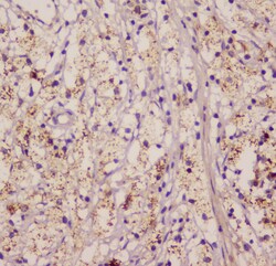 Invitrogen EML4 Polyclonal Antibody 100 &mu;g; Unconjugated:Antibodies,