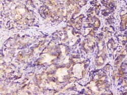 Invitrogen EML4 Polyclonal Antibody 100 &mu;g; Unconjugated:Antibodies,