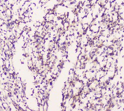Invitrogen EML4 Polyclonal Antibody 100 &mu;g; Unconjugated:Antibodies,