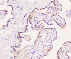 Invitrogen EML4 Polyclonal Antibody 100 &mu;g; Unconjugated:Antibodies,