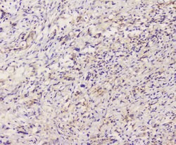 Invitrogen EML4 Polyclonal Antibody 100 &mu;g; Unconjugated:Antibodies,