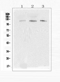 Invitrogen EML4 Polyclonal Antibody 100 &mu;g; Unconjugated:Antibodies,