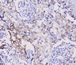 Invitrogen NSE Polyclonal Antibody 100 &mu;g; Unconjugated:Antibodies,