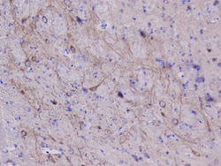 Invitrogen NSE Polyclonal Antibody 100 &mu;g; Unconjugated:Antibodies,