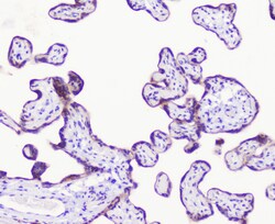 Invitrogen LATS1 Polyclonal Antibody 100 &mu;g; Unconjugated:Antibodies,