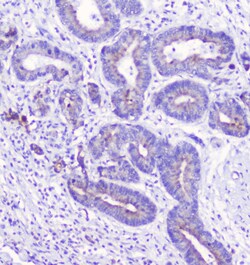 Invitrogen LATS1 Polyclonal Antibody 100 &mu;g; Unconjugated:Antibodies,