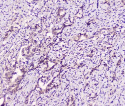 Invitrogen LATS1 Polyclonal Antibody 100 &mu;g; Unconjugated:Antibodies,