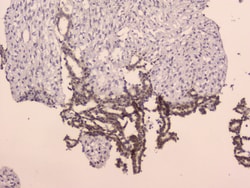 Invitrogen LRIG1 Polyclonal Antibody 100 &mu;g; Unconjugated:Antibodies,