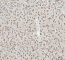 Invitrogen NOVA1 Polyclonal Antibody 100 &mu;g; Unconjugated:Antibodies,