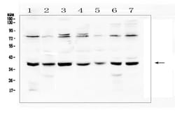 Invitrogen RAD51 Polyclonal Antibody 100 &mu;g | Buy Online | Invitrogen&trade; | Fisher Scientific