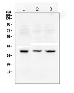 Invitrogen RAD51 Polyclonal Antibody 100 &mu;g | Buy Online | Invitrogen&trade; | Fisher Scientific