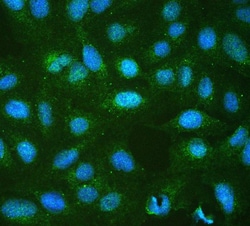 Invitrogen RP2 Polyclonal Antibody 100 &mu;g; Unconjugated:Antibodies,
