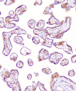Invitrogen RP2 Polyclonal Antibody 100 &mu;g; Unconjugated:Antibodies,