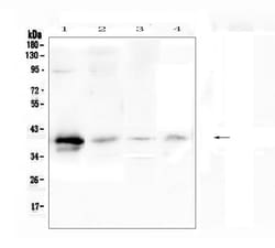Invitrogen RP2 Polyclonal Antibody 100 &mu;g; Unconjugated:Antibodies,