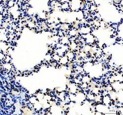 Invitrogen SP1 Polyclonal Antibody 100 &mu;g; Unconjugated:Antibodies,