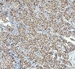 Invitrogen SP1 Polyclonal Antibody 100 &mu;g; Unconjugated:Antibodies,