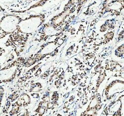 Invitrogen SP1 Polyclonal Antibody 100 &mu;g; Unconjugated:Antibodies,