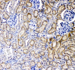 Invitrogen&trade;&nbsp;TNFR1 Polyclonal Antibody
