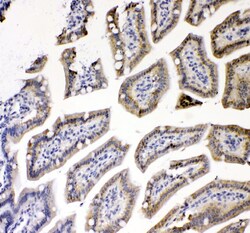 Invitrogen TNFR1 Polyclonal Antibody 100 &mu;g | Buy Online | Invitrogen&trade; | Fisher Scientific