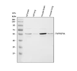 Invitrogen TNFR1 Polyclonal Antibody 100 &mu;g | Buy Online | Invitrogen&trade; | Fisher Scientific