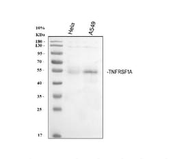 Invitrogen TNFR1 Polyclonal Antibody 100 &mu;g | Buy Online | Invitrogen&trade; | Fisher Scientific