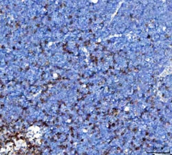 Invitrogen TRAC Polyclonal Antibody 100 &mu;g; Unconjugated:Antibodies,