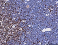 Invitrogen TRAC Polyclonal Antibody 100 &mu;g; Unconjugated:Antibodies,