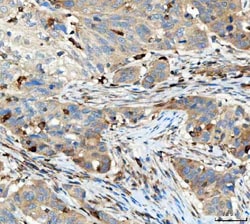 Invitrogen TRAC Polyclonal Antibody 100 &mu;g; Unconjugated:Antibodies,