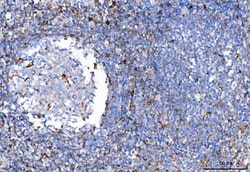 Invitrogen TRAC Polyclonal Antibody 100 &mu;g; Unconjugated:Antibodies,