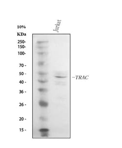 Invitrogen TRAC Polyclonal Antibody 100 &mu;g; Unconjugated:Antibodies,