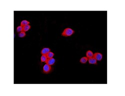 Invitrogen TRPM7 Polyclonal Antibody 100 &mu;g; Unconjugated:Antibodies,