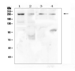 Invitrogen TRPM7 Polyclonal Antibody 100 &mu;g; Unconjugated:Antibodies,