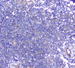 Invitrogen&trade;&nbsp;BTLA Polyclonal Antibody