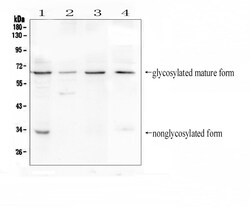 Invitrogen BTLA Polyclonal Antibody 100 &mu;g | Buy Online | Invitrogen&trade; | Fisher Scientific