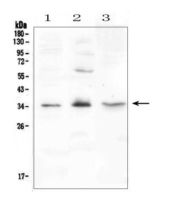 Invitrogen FGF23 Polyclonal Antibody 100 &mu;g; Unconjugated:Antibodies,