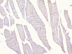 Invitrogen PCDH15 Polyclonal Antibody 100 &mu;g | Buy Online | Invitrogen&trade; | Fisher Scientific