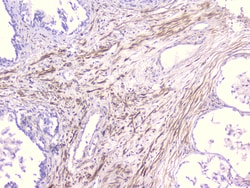 Invitrogen&trade;&nbsp;PCDH15 Polyclonal Antibody